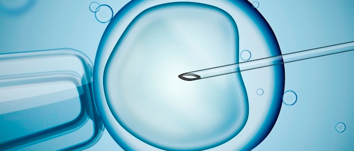 tecnologia-e-recurso-no-combate-a-gravidez-multipla-blog-medicina-reprodutiva-dr-fabio-eugenio